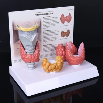Анатомическая модель щитовидной железы человека, дисплей патологической анатомии пищеварительной системы