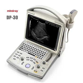 Дешевый ультразвуковой аппарат Mindray, полностью цифровой ультразвуковой аппарат, портативный ультразвуковой сканер Mindray DP-30